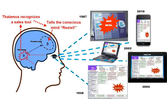 The Brain